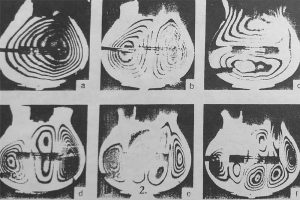Laser holography of a Ramirez guitar, showing the resonant modes of vibration in the soundboard